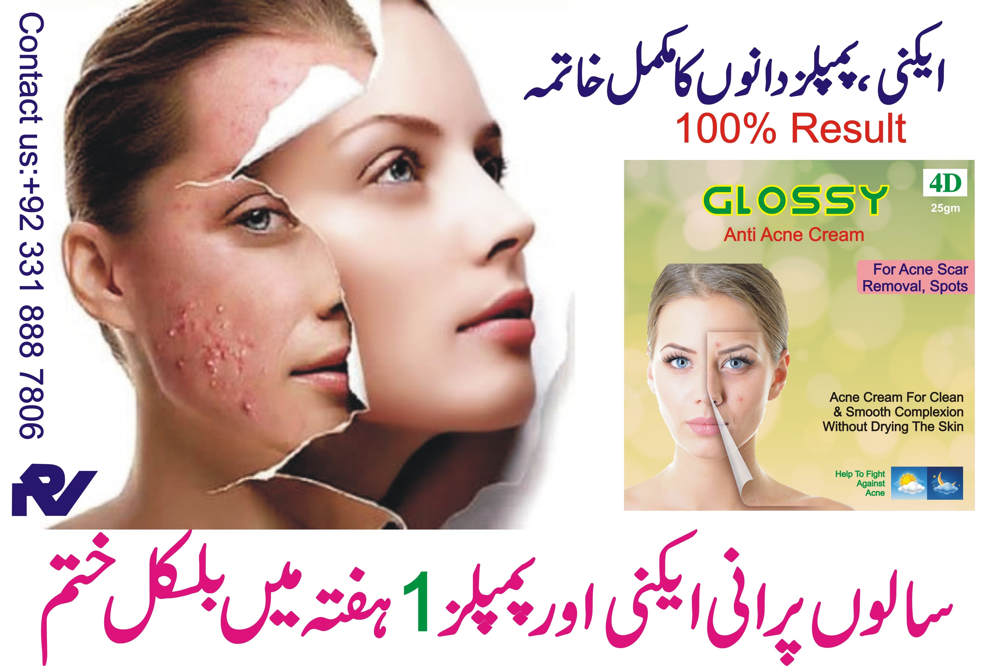 Glossy Anti Acne (Cream)