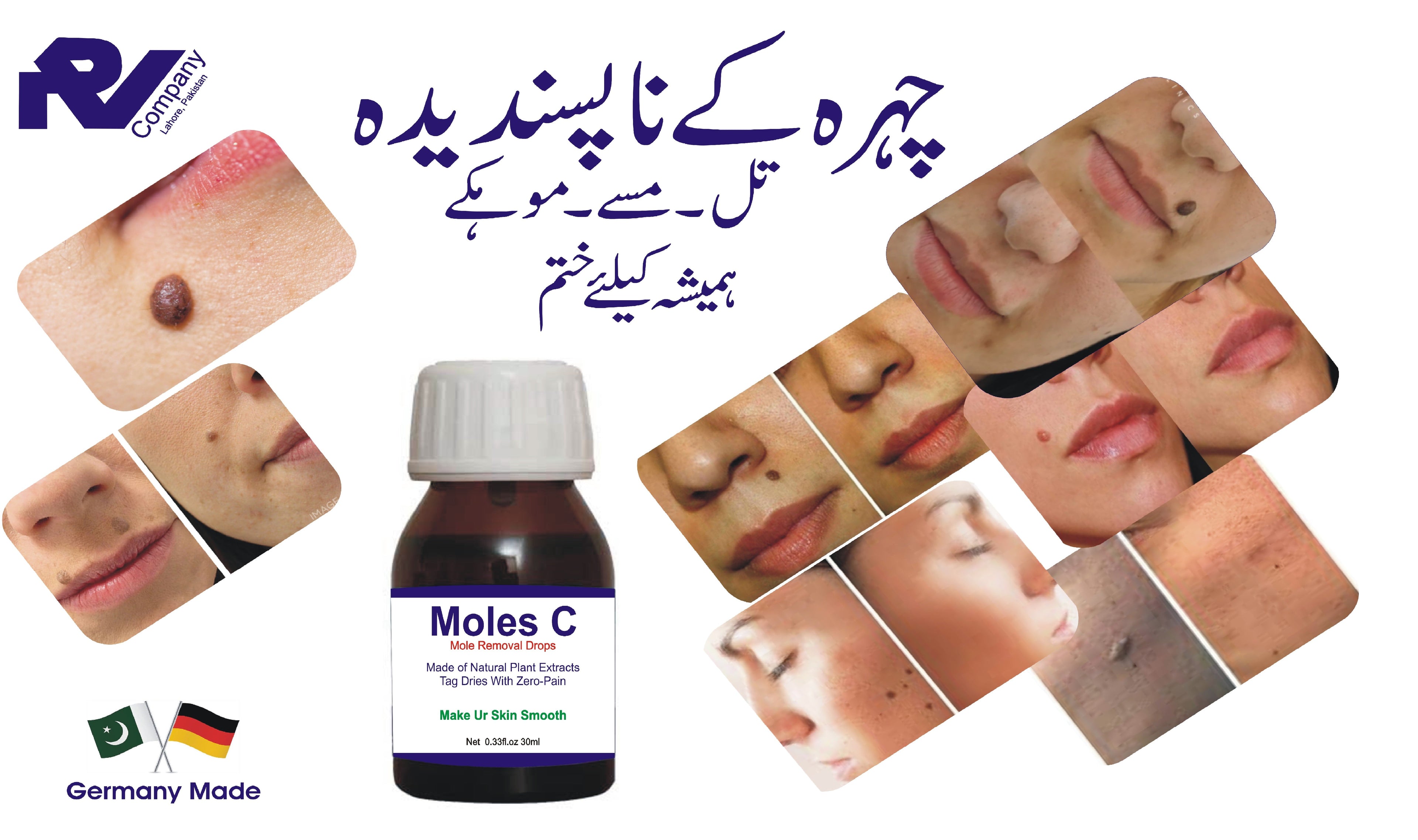 Moles C (30ml drops)